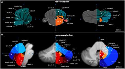 Cerebellar contributions to fear-based emotional processing: relevance to understanding the neural circuits involved in autism
